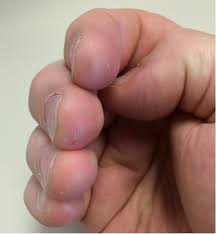Maybe you would like to learn more about one of these? Fingertip Care For Guitarists Music Practice Theory Stack Exchange