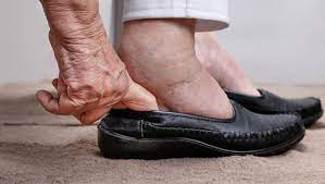 Telapak kaki adalah suatu sistem otot dan rangka yang rumit penyokong seluruh tubuh. Kaki Selalu Rasa Kebas Awas Anda Mungkin Hidap Kencing Manis 5 Penyakit Ini