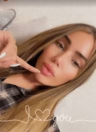 Dans la guerre contre n'allons pas trop vite en besogne, pour manon marsault, la chirurgie esthétique est envisageable. Chirurgie Esthetique Ratee De Manon Marsault Je Ne Supporte Plus Mes Levres