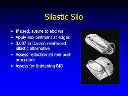 Survival was better in patients in whom primary closure could be achieved in both omp and gs. Management Of Omphalocele From Conception To Closure Ppt Video Online Download