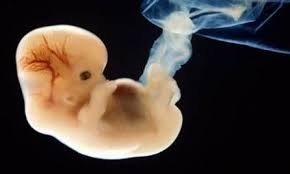 En ce 2ème mois de grossesse, l'acide folique (ou vitamine b 9) est très importante pour la fabrication du. 10 Photos Extraordinaires De La Croissance D Un Bebe Dans Le Ventre D Une Mere