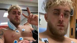 — jake paul (@jakepaul) may 6, 2021. Jake Paul Shows Bloody Footage Of Broken Nose He Suffered 3 Weeks Before Fight