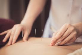 Maybe you would like to learn more about one of these? L Acupuncture Est Efficace Contre Les Bouffees De Chaleur Alternatif Bien Etre