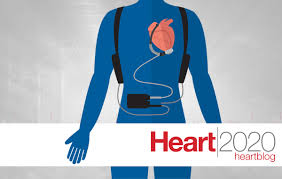 You may have a vad implanted while you wait for a heart transplant or for your heart to become strong enough to effectively pump blood on its own. Lvads No Longer Just A Bridge But A Long Term Alternative To Heart Transplant Heart Ut Southwestern Medical Center