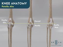 Image result for Patella aspera