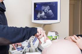 Diese verbietet ab dem 1. Ultraschall In Schwangerschaft Frauenarzte Babykino Ist Ab 2021 Verboten Wissen Stuttgarter Zeitung