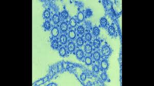 Rhinovirus enters a cell after attaching to the icam receptor. Flu Under The Microscope