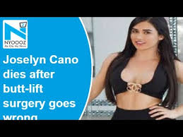 La influencer estadounidense joselyn cano falleció por presuntas complicaciones de una cirugía #joselyncano. Mexican Influencer Joselyn Cano Dies After Butt Lift Surgery Goes Wrong Youtube