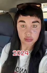 Amanda Bynes transformation is heart breaking 🥹