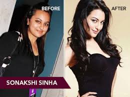 Sonakshi became an sonakshi sinha weight loss overnight sensation after the magnificent results dabbing box office. Sonakshi Sinha Weight Loss Prettislim