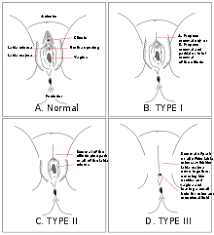 الماشية يطلب سلبي طريقة ختان النساء بالصور dsvdedommel com