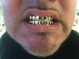 Prime time grillz specializes in custom gold grillz. 14k Gold Grills 8 Top 8bottom Solid With Deep Cut Permanent Looking Custom Fit Ebay