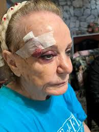 This is not Ok! I would be mortified if a loved one was falling