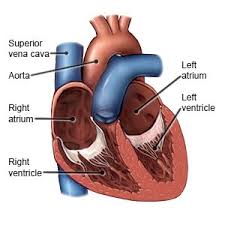 Image result for Restrictive Cardiomyopathy