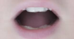 When you have a swollen tongue it can be just a portion of it that is swollen or it can be the whole tongue. Covid Tongue May Be Another Coronavirus Symptom British Researcher Suggests