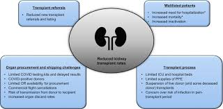 The Impact Of Covid 19 On Kidney Transplantation And The Kidney Transplant Recipient One Year Into The Pandemic Khairallah 2021 Transplant International Wiley Online Library