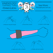 Kinesiology Taping Tips For Tennis Elbow Infographic Fit As A Physio Strapping Tape Sports Med Kinesiology Taping Tennis Elbow Kinesiology