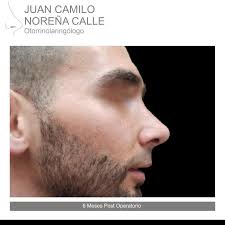 drjuancamilonorenaorl