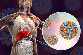 Jika sedang merawat pasien hepatitis, penting bagi anda untuk memahami jenis virus serta tips keamanannya. Kenali Beragam Cara Penularan Hepatitis B Halaman All Kompas Com