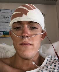 Best friends' 24-hour trek for brain cancer patient given months to li