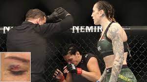 Cat zingano speaks to the media at ufc phoenix about her health and state of the eye injury she sustained against megan anderson. Cat Zingano Shows Off Nasty Effects Of Toe To Her Eye Sportsjoe Ie