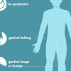 Cancer signs and symptoms during the coronavirus pandemic. 1