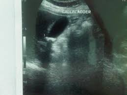 Maybe you would like to learn more about one of these? Dokter Ari S Blog Dokterari
