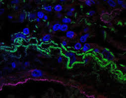 Study sheds light on immune mechanism that triggers cytokine storm typical  of COVID-19 | EurekAlert! Science News