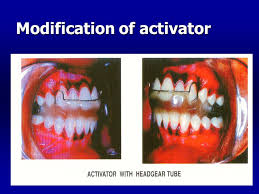 Herrens modification of the activator. Ø¨Ø³Ù… Ø§Ù„Ù„Ù‡ Ø§Ù„Ø±Ø­Ù…Ù† Ø§Ù„Ø±Ø­ÙŠÙ… Dr Hakam Husham Ppt Video Online Download