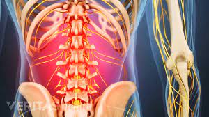 A problem in another part of the body, such as the reproductive organs, can also radiate to the lower back. 7 Back Pain Conditions That Mainly Affect Women