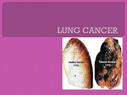 To be similar in appearance to; What Is Cancer The Word Cancer Actually Refers To Many Diseases Not One In Fact There Are More Than 100 Types Of Diseases Known Collectively As Ppt Download
