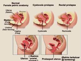 Di periode dpr ri saat ini, jumlah perempuan yang menempati kursi dpr mencapai 120 orang atau 20,87 persen dari total 575 kursi di dpr. Nurul Jamu Susuk Dara Sarawak Publications Facebook