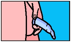 Wrap the sheath holder around the condom at the base of your penis. How To Put On A Condom Saint Luke S Health System