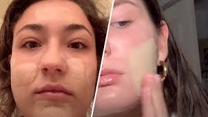 It was like it wouldn't stop growing, and spot treatment solution was doing absolutely nothing. How Hydrocolloid Bandages Aka Pimple Patches Heal Acne Allure