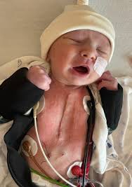 Shortly after birth, Hunter was taken for a routine checkup, where doctors  detected a heart murmur. Further evaluation revealed news no parent is ever  prepared for—Hunter had three congenital heart defects: an