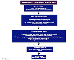 Image result for Transcutaneous Pacing
