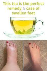 A Homemade Tea For Occasional Swollen Feet Water Retention Remedies Foot Remedies Health Remedies
