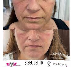 Sibel Sibel Demir (@sibeldemirguzellik) · Instagram 照片和视频