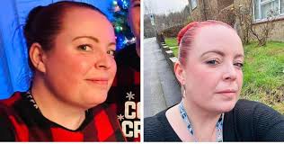 2 weeks difference in my face, 14lb down 🙌🏼❤️