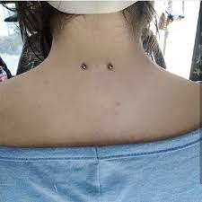 Nape Surface Piercing Made By Our Body Piercer Bg Mess Done At Our Studio Call Us Today 351 962 481 652 Li Surface Piercing Body Piercings Body
