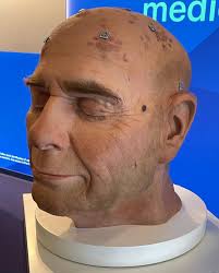 Dr.ssa Raffaella Anfuso