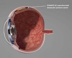 Glaucoma News