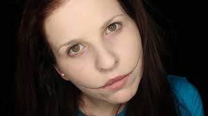 A glasgow smile (also known as a glasgow, chelsea, or cheshire grin) is a wound caused by making small cuts on the corners of a victim's mouth, then this leaves a scar in the shape of a smile, hence the name. Chelsea Grin Scar Makeup Saubhaya Makeup