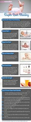 Stop Diaper Rash Bleeding Diaper Rash Remedy Baby Rash Baby Remedies