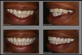 Pin On Cosmetic Dentistry