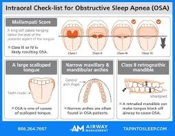 self check for sleep apnea by looking at your own mouth all