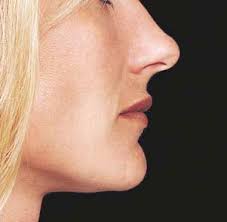 FACIAL ANALYSIS: A COMPREHENSIVE APPROACH TO TREATMENT PLANNING IN  AESTHETIC DENTISTRY