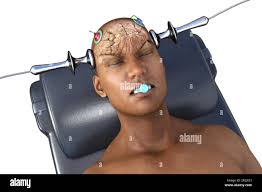 Shock treatment therapy hi-res stock photography and images