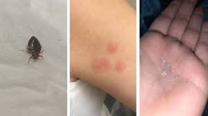 Nov 21, 2019 · les punaises de lit sont des insectes parasites qui se nichent dans les recoins des logements, particulièrement dans les matelas, les fauteuils ou les fissures des murs. Punaises De Lit A Liege Christine Et Paul Ont Fini Par Demenager Car C Etait Le Seul Moyen De Mettre Fin A Ce Cauchemar Rtl Info