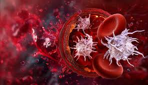Image result for Platelet Transfusion